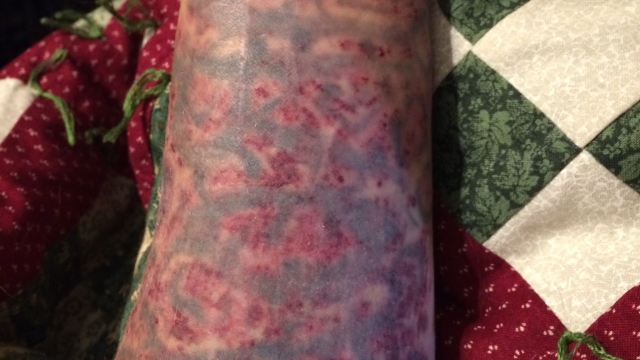 Cost Of Tattoo Removal – Options Depending On Budget