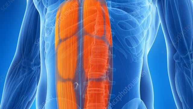 Flatten Your Tummy: The Ultimate Guide to Abdominoplasty