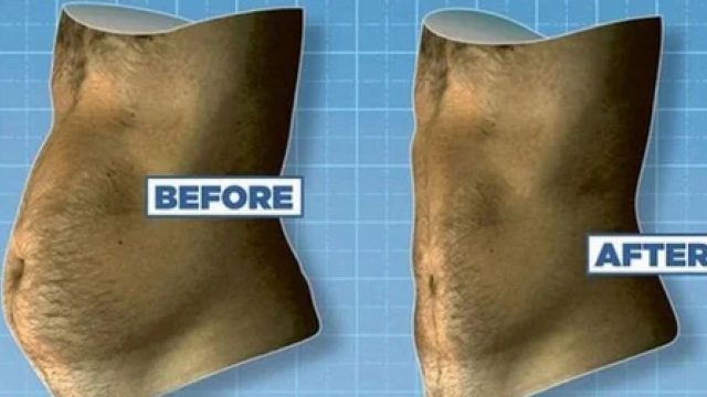 Sculpting a New You: Unveiling the Secrets of Liposuction