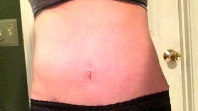Sculpting Your Body: Unveiling the Secrets of Liposuction