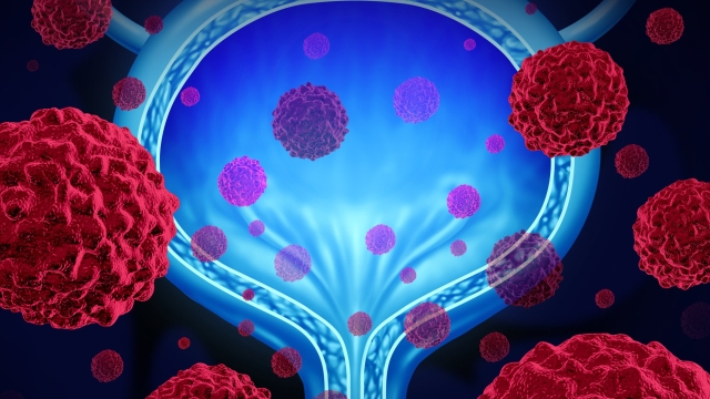 Unveiling the Secrets of Urology: Exploring the Intricacies of the Urinary System